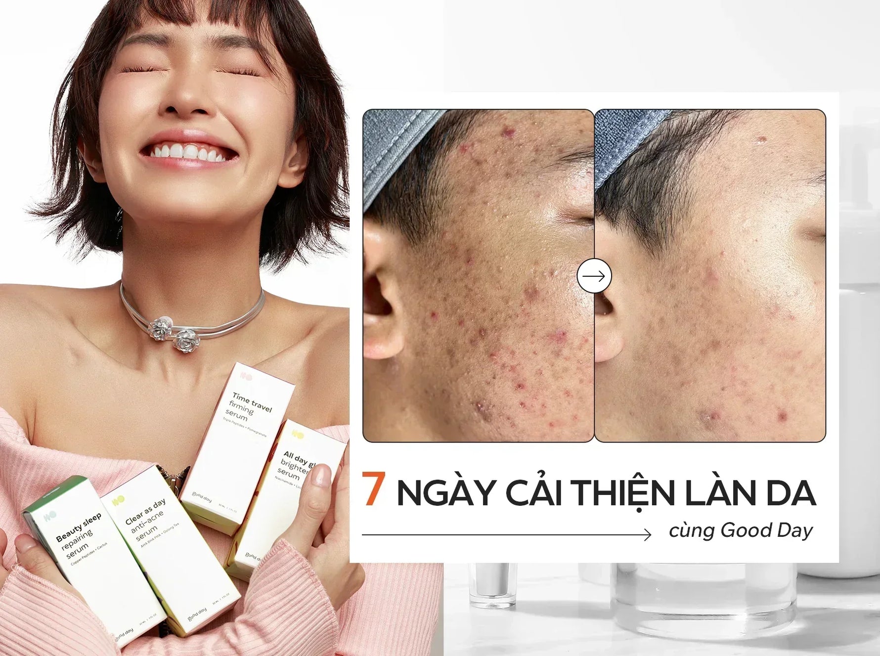 7 ngày cải thiện làn da cùng sản phẩm Good Day Vietnam