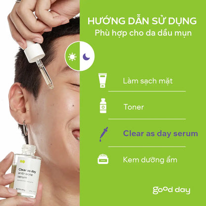 Serum trị mụn Clear As Day 30ml